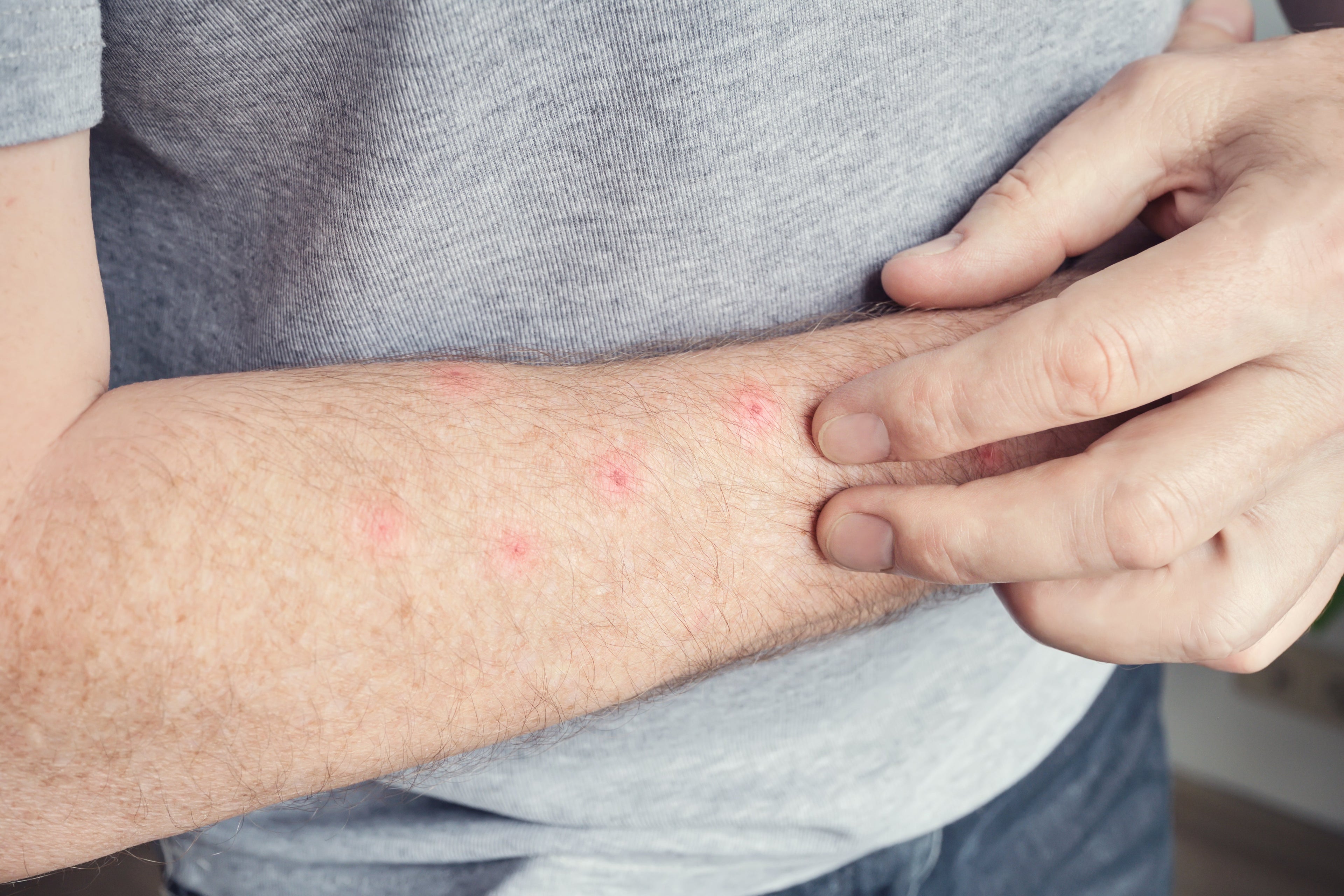 Línea de Máxima Protección